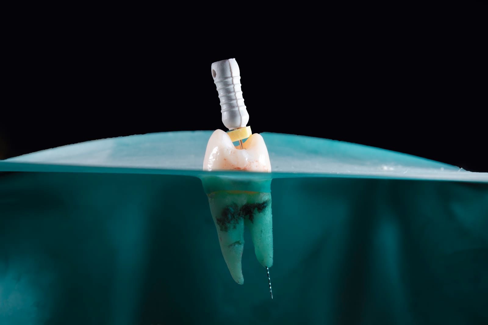 Model zęba z widocznym kanałem podczas leczenia endodontycznego